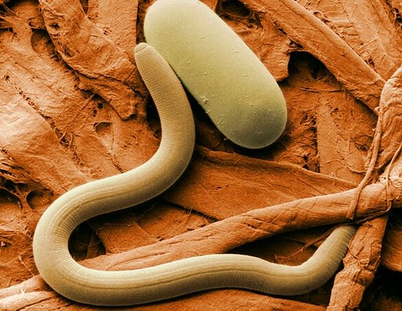 What do nematodes look like 