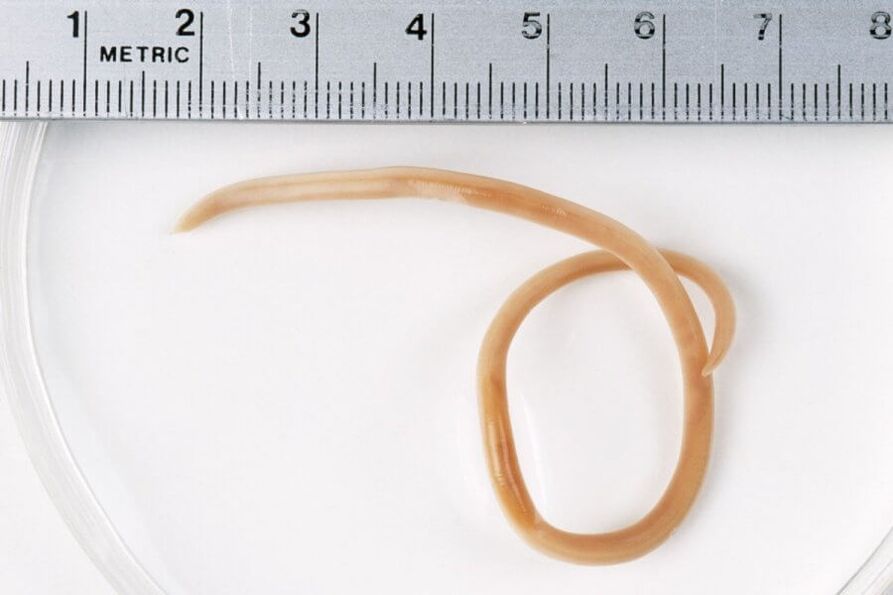 scar worms are round worms that live in the human body