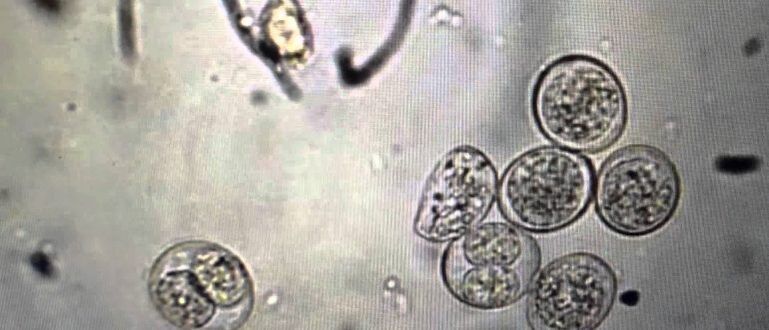 Protozoan parasite cell