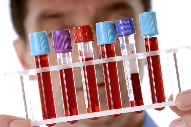 blood tests to diagnose helminthiasis